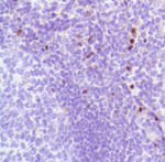 FOXP3 Antibody in Immunohistochemistry (Paraffin) (IHC (P))