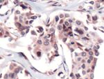 FPGS Antibody in Immunohistochemistry (IHC)