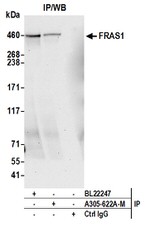 FRAS1 Antibody in Western Blot (WB)