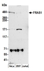FRAS1 Antibody in Western Blot (WB)