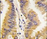 FRAT1 Antibody in Immunohistochemistry (IHC)