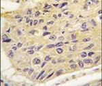 FRAT1 Antibody in Immunohistochemistry (IHC)