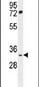 FRG2B Antibody in Western Blot (WB)