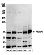 FRMD6 Polyclonal Antibody