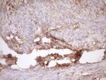 FSCN1 Antibody in Immunohistochemistry (Paraffin) (IHC (P))