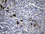 FSCN1 Antibody in Immunohistochemistry (Paraffin) (IHC (P))