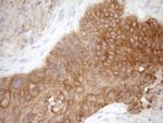 FSCN1 Antibody in Immunohistochemistry (Paraffin) (IHC (P))