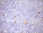 FSCN1 Antibody in Immunohistochemistry (Paraffin) (IHC (P))