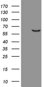 FSCN1 Antibody in Western Blot (WB)