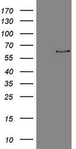 FSCN1 Antibody in Western Blot (WB)