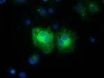 FSHB Antibody in Immunocytochemistry (ICC/IF)