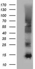 FSHB Antibody in Western Blot (WB)