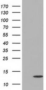 FSHB Antibody in Western Blot (WB)