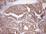 FSIP1 Antibody in Immunohistochemistry (Paraffin) (IHC (P))