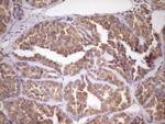 FSIP1 Antibody in Immunohistochemistry (Paraffin) (IHC (P))