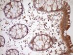 FSIP1 Antibody in Immunohistochemistry (Paraffin) (IHC (P))