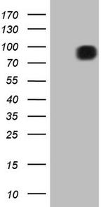 FSIP1 Antibody in Western Blot (WB)