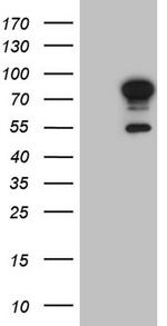 FSIP1 Antibody in Western Blot (WB)