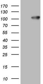 FSIP1 Antibody in Western Blot (WB)