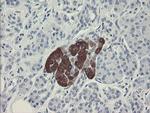 FTCD Antibody in Immunohistochemistry (Paraffin) (IHC (P))