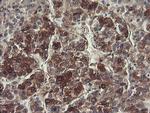FTCD Antibody in Immunohistochemistry (Paraffin) (IHC (P))