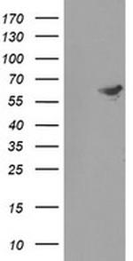 FTCD Antibody in Western Blot (WB)