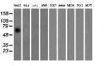 FTCD Antibody in Western Blot (WB)