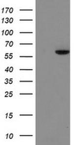 FTCD Antibody in Western Blot (WB)