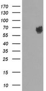 FTCD Antibody in Western Blot (WB)