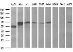 FTCD Antibody in Western Blot (WB)