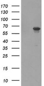 FTCD Antibody in Western Blot (WB)