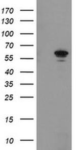 FTCD Antibody in Western Blot (WB)