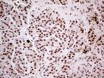 FTO Antibody in Immunohistochemistry (Paraffin) (IHC (P))