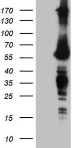 FTO Antibody in Western Blot (WB)