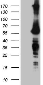 FTO Antibody in Western Blot (WB)