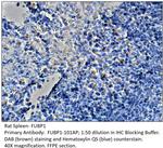 FUBP1 Antibody in Immunohistochemistry (IHC)