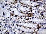 FUBP3 Antibody in Immunohistochemistry (Paraffin) (IHC (P))