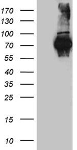 FUBP3 Antibody in Western Blot (WB)