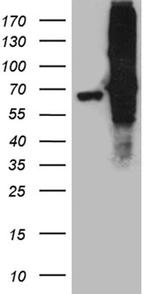 FUBP3 Antibody in Western Blot (WB)