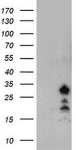 FXN Antibody in Western Blot (WB)
