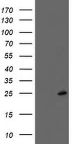 FXN Antibody in Western Blot (WB)