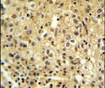 FYTTD1 Antibody in Immunohistochemistry (IHC)