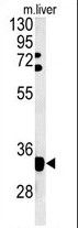 FYTTD1 Antibody in Western Blot (WB)