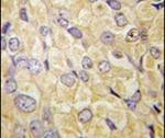 FZD1 Antibody in Immunohistochemistry (IHC)