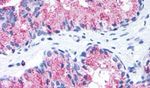 FZD1 Antibody in Immunohistochemistry (Paraffin) (IHC (P))