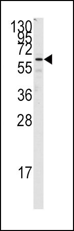 FZD1 Antibody in Western Blot (WB)