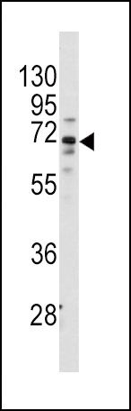 FZD1 Antibody in Western Blot (WB)