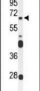 FZD4 Antibody in Western Blot (WB)