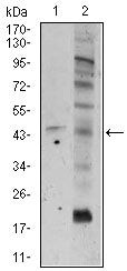 FZD5 Monoclonal Antibody (2D12)