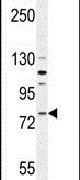 FZD6 Antibody in Western Blot (WB)